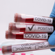 Illustration for article titled Coronavirus Infected 9 People in One Black Family. 3 Died. They Still Have Trouble Getting Tested